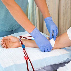 Dialysis Access | Vascular Surgeon Cape Town