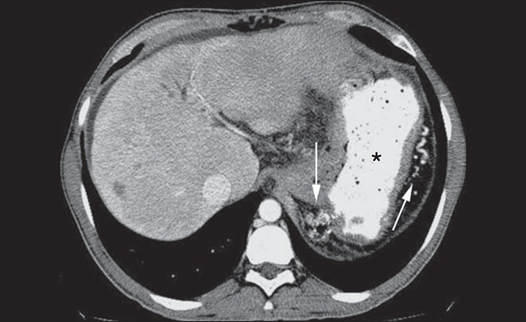 Active Haemorrhage Treatment | Dr JP Mouton