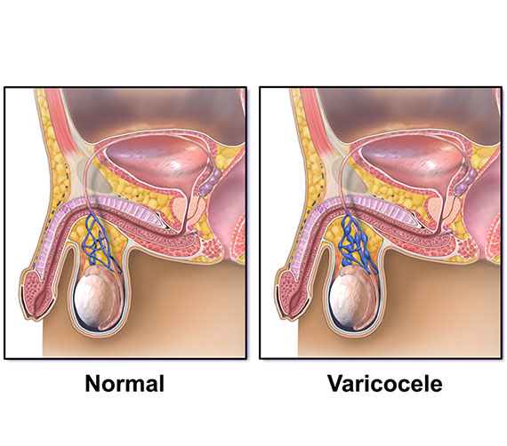 Embolization | Dr JP Mouton